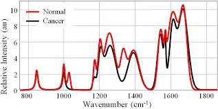 Raman Spectroscopy in Cancer Diagnostics