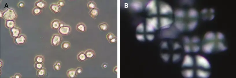 The Urinary Sediment View Under Phase Contrast Microscope