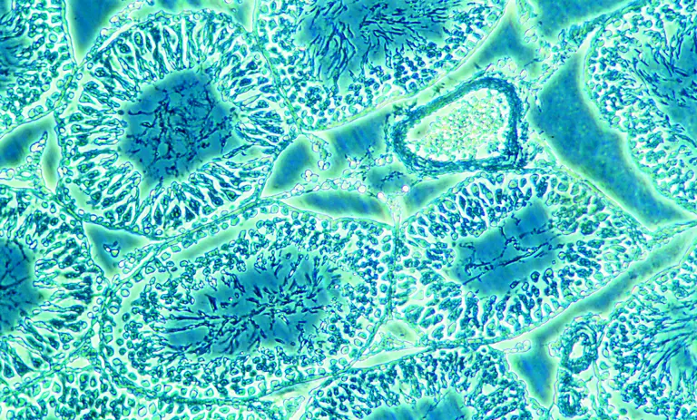 The inside View Of Phase Contrast Microscope 