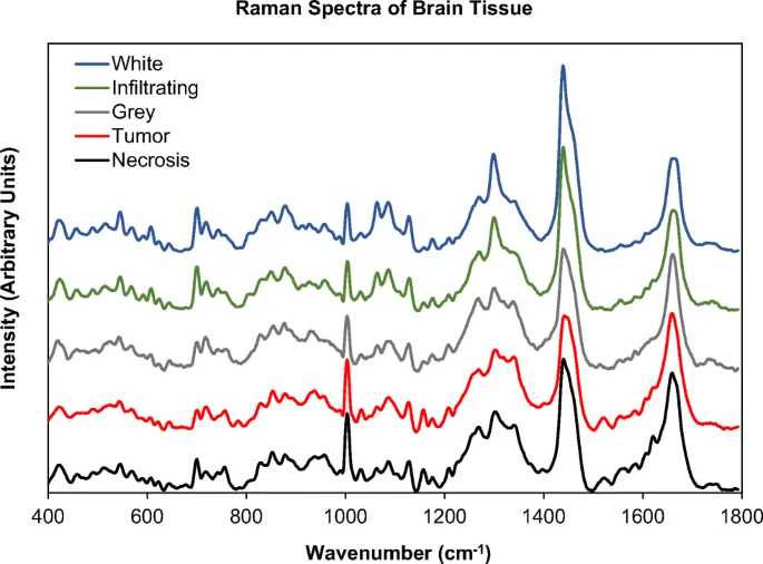 Raman Spectroscopy in Cancer Diagnosis