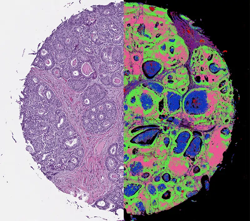 The Optical microscope In Pathology Study 