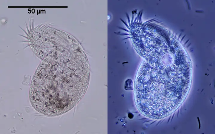 The Phase Contrast Illumination Of A Bacteria 