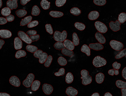 The View After The Segmentation Process 