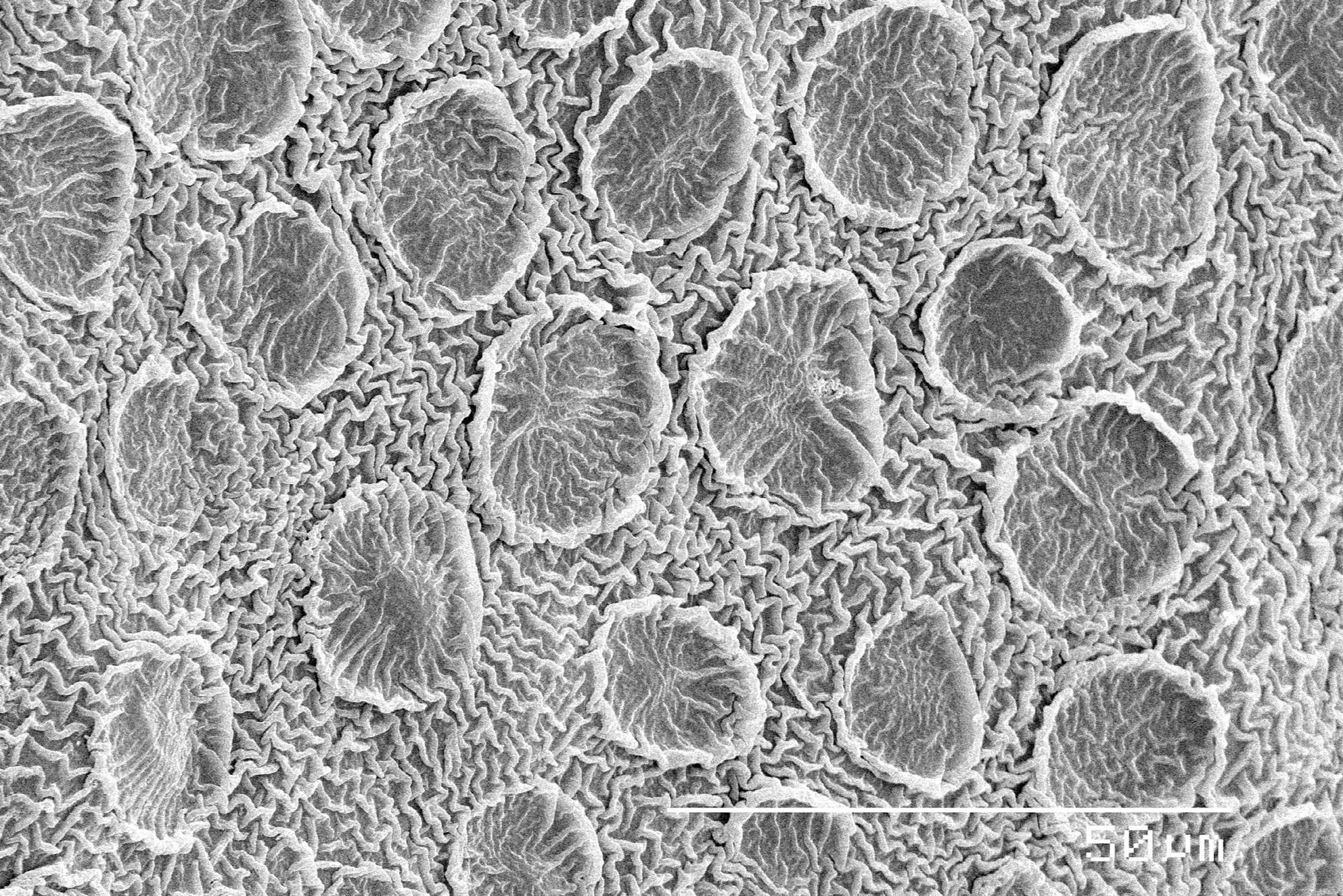 Getting Sharper Images Of Thick Biological Specimens With Microscopy Techniques