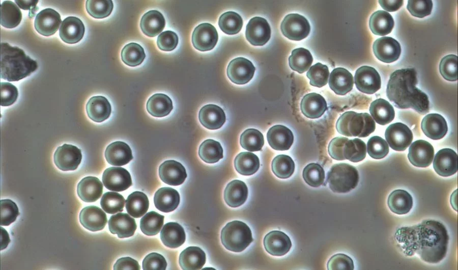 The Contrasted View Of Cross-Sectional Area Of A Biological Sample